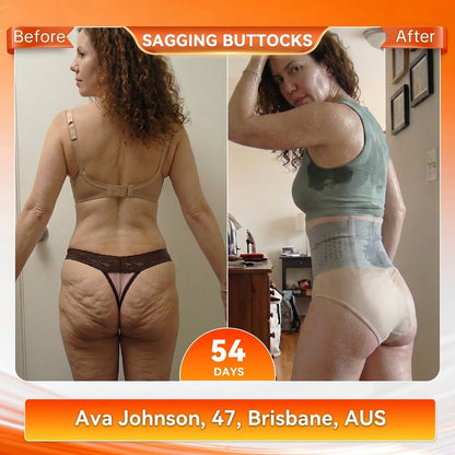 🇦🇺👩‍⚕️𝐎𝐟𝐟𝐢𝐜𝐢𝐚𝐥 𝐁𝐫𝐚𝐧𝐝 𝐒𝐭𝐨𝐫𝐞 |✅𝐊𝐊𝐈𝐎® 𝟐𝟎𝟐𝟔 𝐌𝐨𝐫𝐢𝐧𝐠𝐚 & 𝐁𝐞𝐫𝐛𝐞𝐫𝐢𝐧𝐞 𝟒-𝐈𝐧-𝟏 𝐌𝐢𝐜𝐫𝐨-𝐏𝐚𝐫𝐭𝐢𝐜𝐥𝐞 𝐒𝐜𝐮𝐥𝐩𝐭𝐢𝐧𝐠 & 𝐅𝐚𝐭-𝐁𝐮𝐫𝐧 𝐒𝐡𝐨𝐫𝐭𝐬