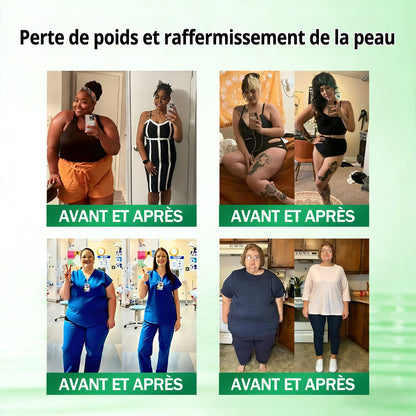 👩‍⚕️ Il ne reste plus que 10 boîtes ! 🎁 Nous offrons une remise supplémentaire de 50 % ! Prenez soin de votre santé ! Si vous manquez cette offre, il n'y en aura plus cette année !