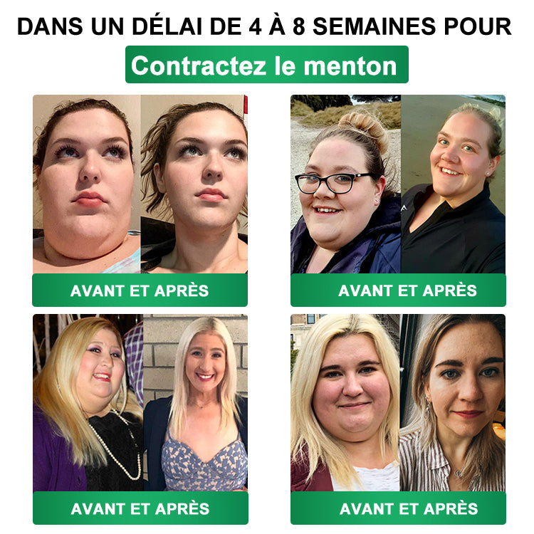 👩‍⚕️ Il ne reste plus que 10 boîtes ! 🎁 Nous offrons une remise supplémentaire de 50 % ! Prenez soin de votre santé ! Si vous manquez cette offre, il n'y en aura plus cette année !