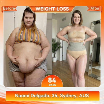 🇦🇺👩‍⚕️𝐎𝐟𝐟𝐢𝐜𝐢𝐚𝐥 𝐁𝐫𝐚𝐧𝐝 𝐒𝐭𝐨𝐫𝐞 |✅𝐊𝐊𝐈𝐎® 𝟐𝟎𝟐𝟔 𝐌𝐨𝐫𝐢𝐧𝐠𝐚 & 𝐁𝐞𝐫𝐛𝐞𝐫𝐢𝐧𝐞 𝟒-𝐈𝐧-𝟏 𝐌𝐢𝐜𝐫𝐨-𝐏𝐚𝐫𝐭𝐢𝐜𝐥𝐞 𝐒𝐜𝐮𝐥𝐩𝐭𝐢𝐧𝐠 & 𝐅𝐚𝐭-𝐁𝐮𝐫𝐧 𝐒𝐡𝐨𝐫𝐭𝐬