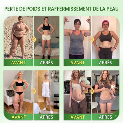 𝑩𝒐𝒖𝒕𝒊𝒒𝒖𝒆 𝑶𝒇𝒇𝒊𝒄𝒊𝒆𝒍𝒍𝒆 | 🍀𝐍𝐨𝐮𝐯𝐞𝐚𝐮 𝐂𝐚𝐫𝐞𝐔𝐩𝐥𝐢𝐟𝐭® 𝐀𝐥𝐠𝐮𝐞 𝐁𝐫𝐮𝐧𝐞 × 𝐁𝐞𝐫𝐛𝐞́𝐫𝐢𝐧𝐞 × 𝐍𝐀𝐃+ 𝟏𝟎-𝐞𝐧-𝟏 𝐏𝐚𝐭𝐜𝐡 𝐍𝐚𝐧𝐨 𝐌𝐢𝐜𝐫𝐨𝐚𝐢𝐠𝐮𝐢𝐥𝐥𝐞𝐬. 𝐔𝐧𝐞 𝐟𝐨𝐢𝐬 𝐩𝐚𝐫 𝐣𝐨𝐮𝐫 ✅ 𝐏𝐨𝐮𝐫 𝐠𝐞𝐬𝐭𝐢𝐨𝐧 𝐝𝐮 𝐩𝐨𝐢𝐝𝐬, 𝐠𝐥𝐲𝐜𝐞́𝐦𝐢𝐞 𝐞𝐭 𝐛𝐢𝐞𝐧-𝐞̂𝐭𝐫𝐞 💯