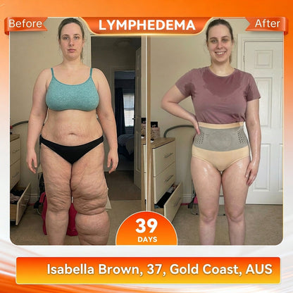 🇦🇺👩‍⚕️𝐎𝐟𝐟𝐢𝐜𝐢𝐚𝐥 𝐁𝐫𝐚𝐧𝐝 𝐒𝐭𝐨𝐫𝐞 |✅𝐊𝐊𝐈𝐎® 𝟐𝟎𝟐𝟔 𝐌𝐨𝐫𝐢𝐧𝐠𝐚 & 𝐁𝐞𝐫𝐛𝐞𝐫𝐢𝐧𝐞 𝟒-𝐈𝐧-𝟏 𝐌𝐢𝐜𝐫𝐨-𝐏𝐚𝐫𝐭𝐢𝐜𝐥𝐞 𝐒𝐜𝐮𝐥𝐩𝐭𝐢𝐧𝐠 & 𝐅𝐚𝐭-𝐁𝐮𝐫𝐧 𝐒𝐡𝐨𝐫𝐭𝐬